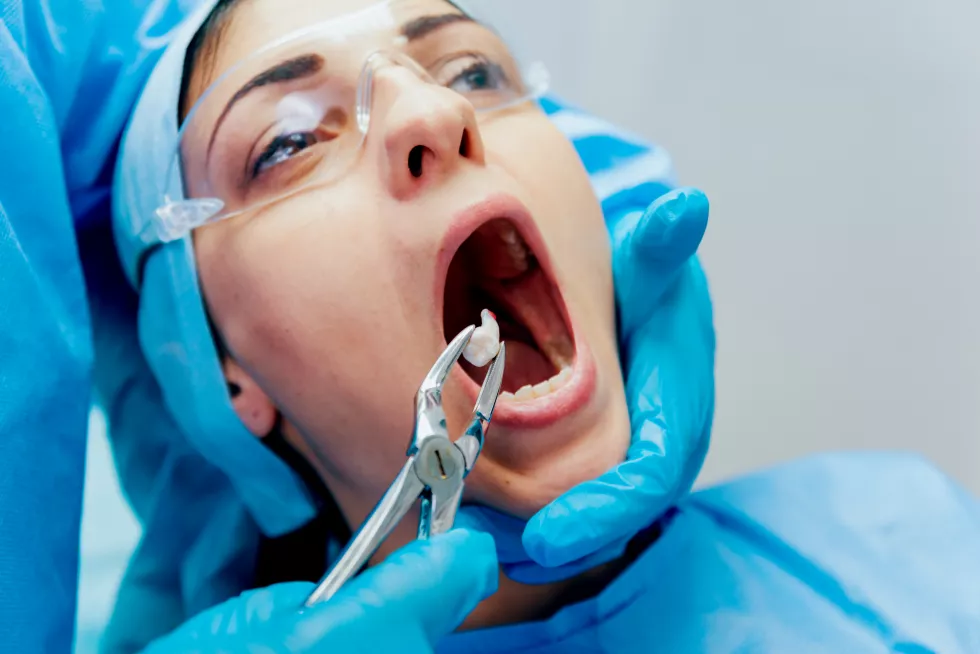 dentist-using-surgical-pliers-remove-decaying-tooth-modern-dental-clinic